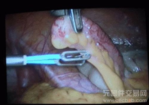 人体20个鲜为人知的秘密:睫毛中或生长着螨虫