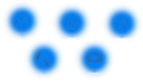 长时间使用电脑或智能手机小心飞蚊症缠身