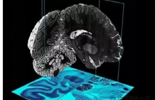 3D打印在神经系统疾病治疗领域前景诱人2