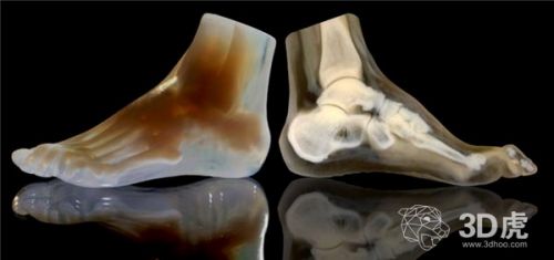 位图技术1小时内获得大脑的3D数据1