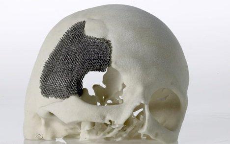 3D打印技术在生物医用材料产业应用展望1